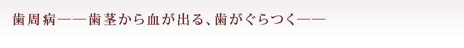 歯周病――歯茎から血が出る、歯がぐらつく――